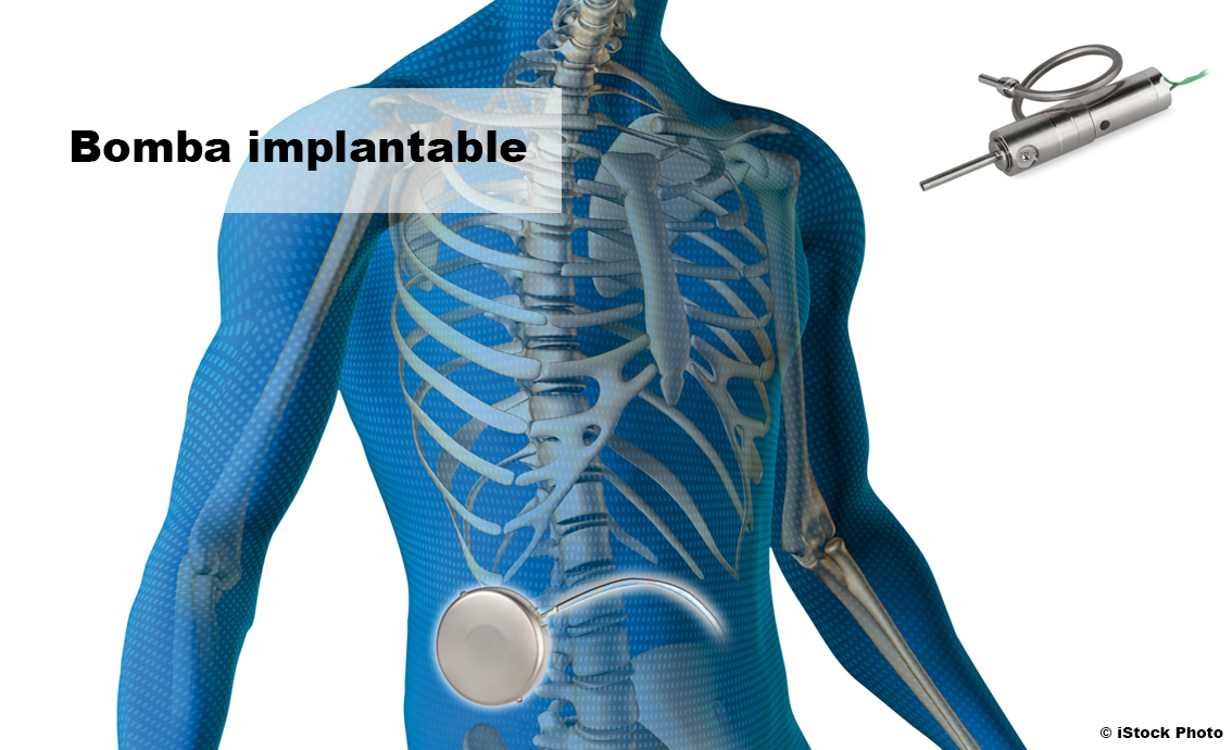 Motor cc en bomba implantable